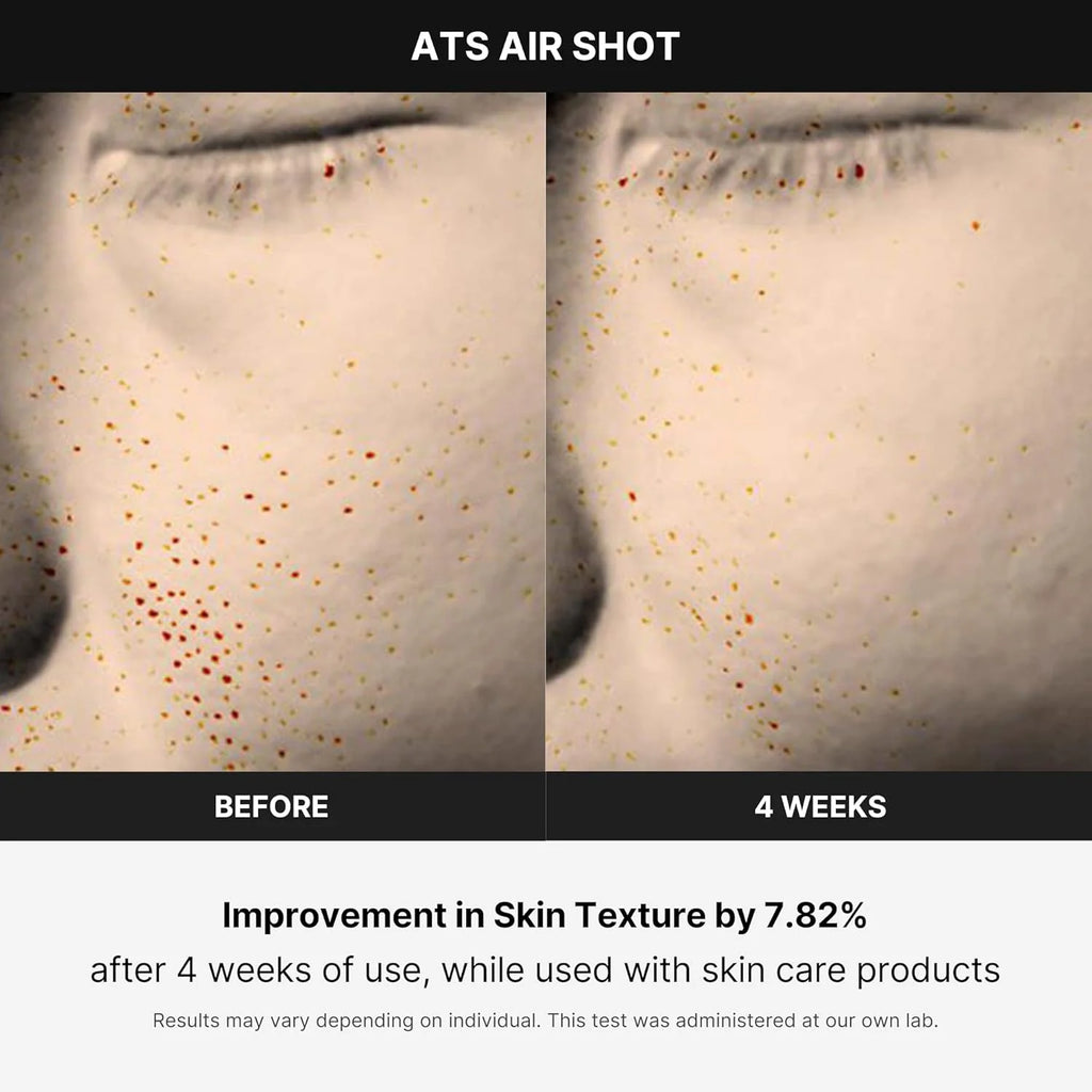 Medicube Age-R ATS Air Shot - Microneedling Pore Tightening Skin Care Device